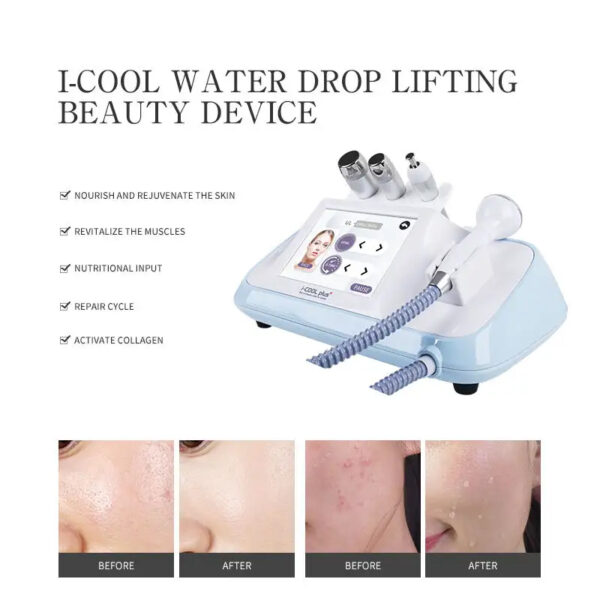 ICOOL PLUS SONIC ULTRASONIC PRODUCT PENERATION DEPTH Product - Image 4