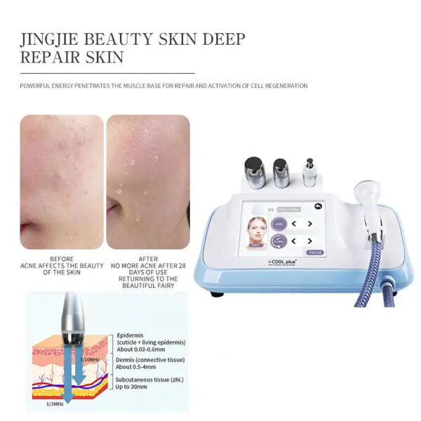 ICOOL PLUS SONIC ULTRASONIC PRODUCT PENERATION DEPTH Product - Image 7