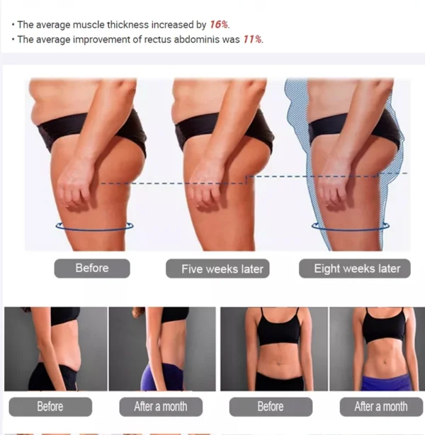 Portable 4 Handles EMS Body Sculpt Body Contouring Slimming Device - Image 5