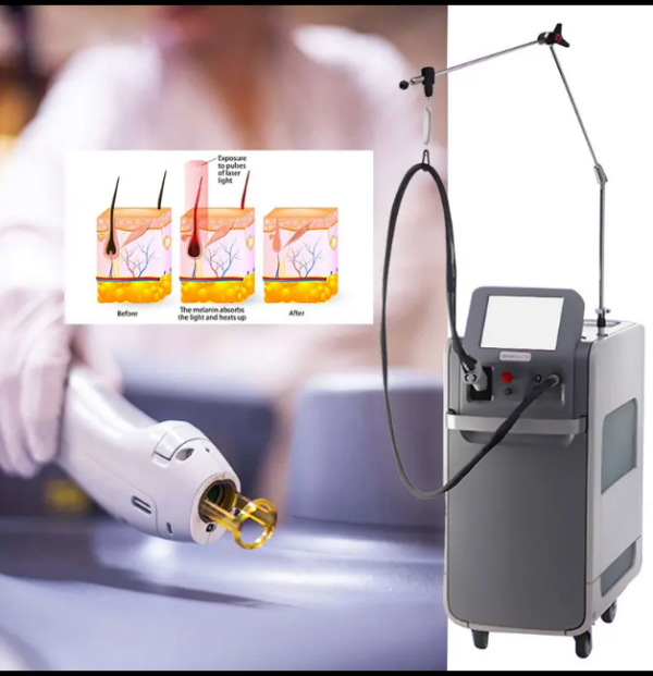 New CANDELA GentleMax Pro