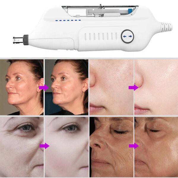 Facial Care Nutrition Face Lightening Rejuvenation Hy-Dra-Skinboosters Meso Gun - Image 5